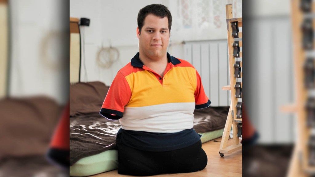Man Born Without Limbs Selling His Art To Buy Bionic&nbsp;Arms